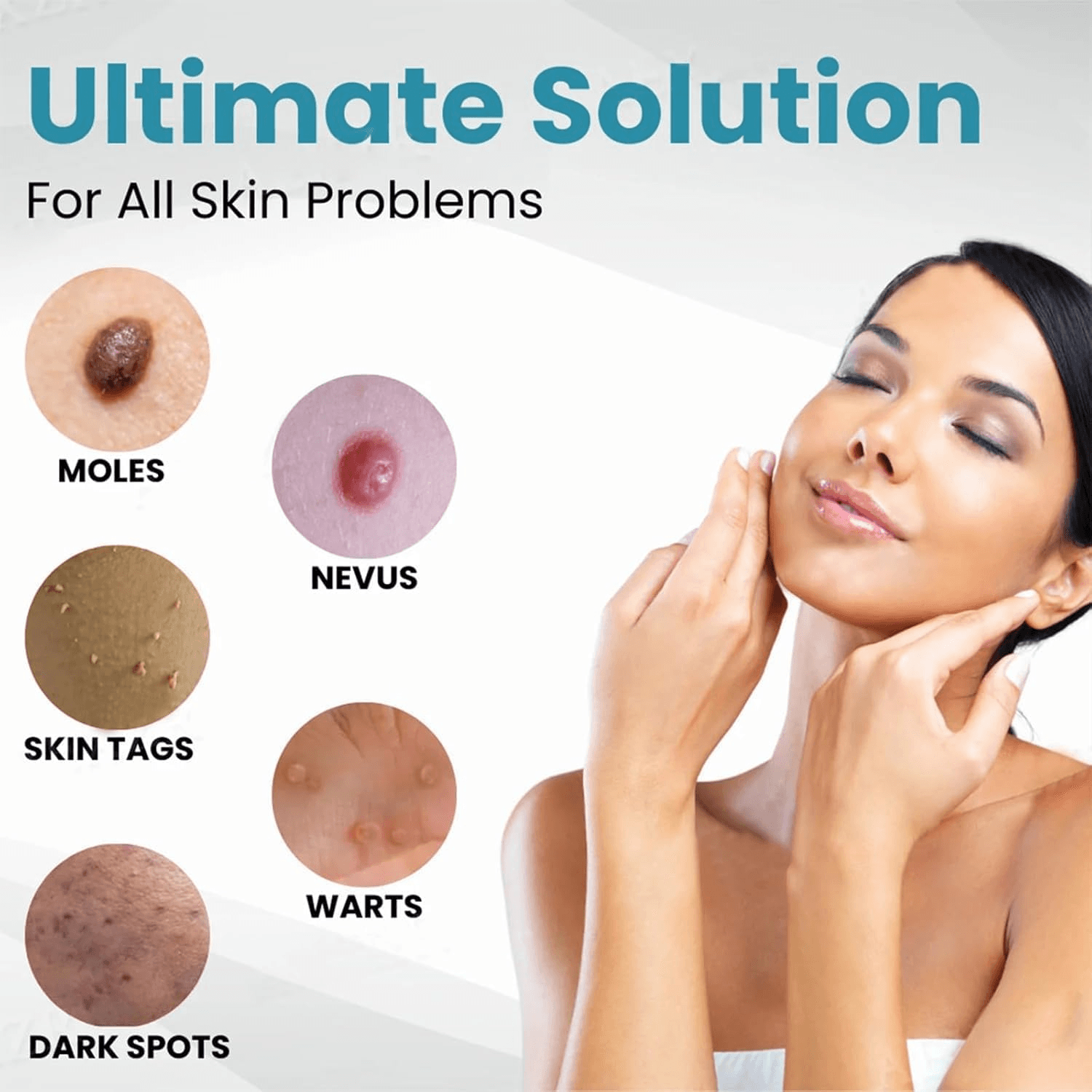 Mole & Wart Removal Laser Pen | Painless Skin Care – Dubai UAE
