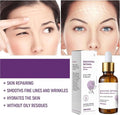 Venature Bakuchiol Retinol Rejuvenation Serum – Anti-Aging Facial Serum 30ml