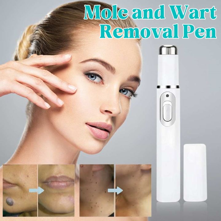 Mole & Wart Removal Laser Pen | Painless Skin Care – Dubai UAE