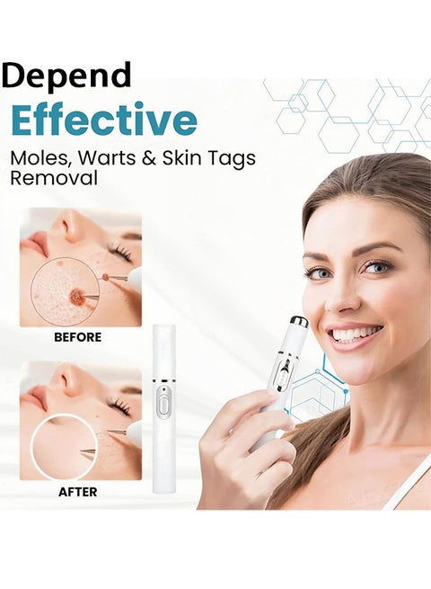 Mole & Wart Removal Laser Pen | Painless Skin Care – Dubai UAE