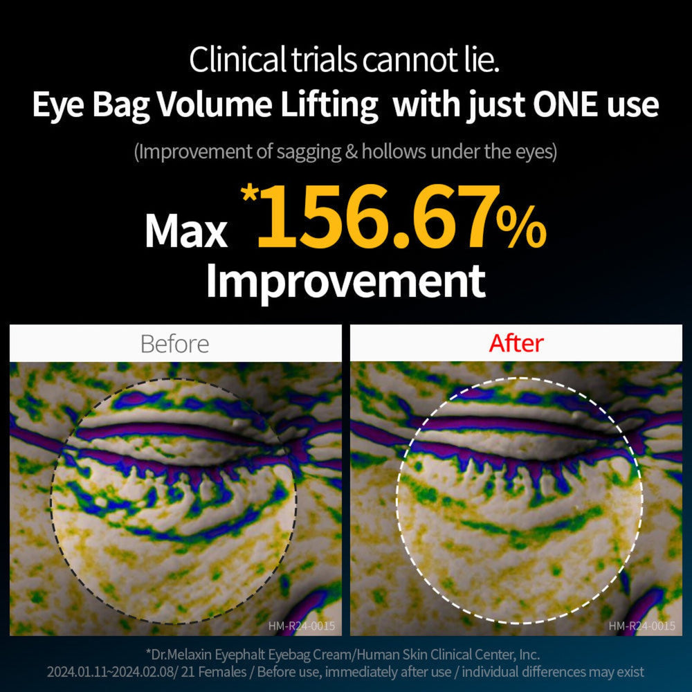 Dr.Melaxin Eyephalt Eye Bag Cream