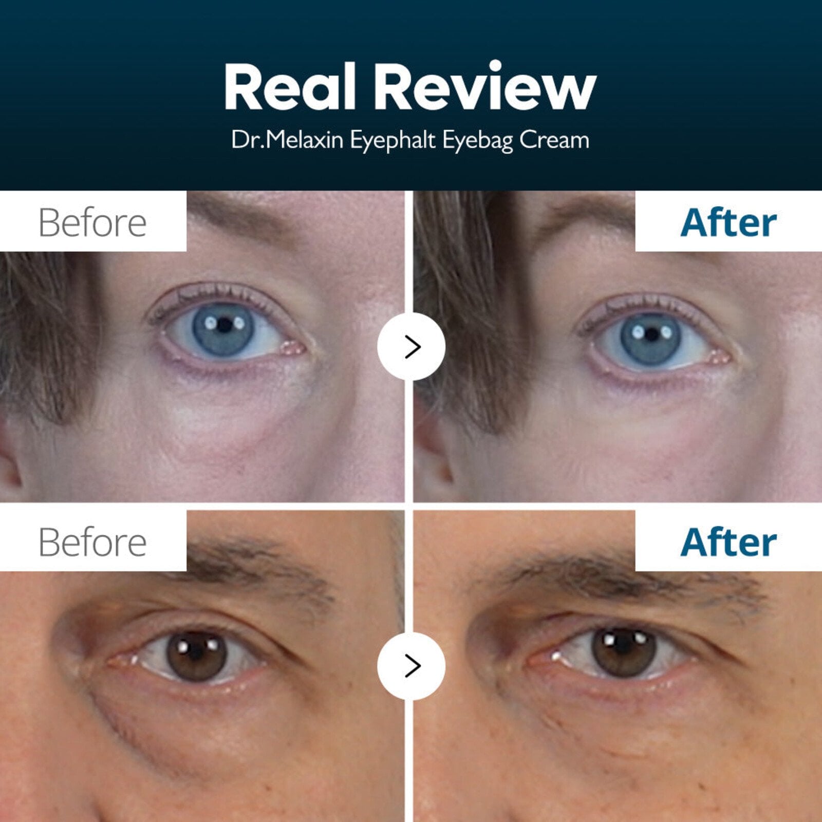 Dr.Melaxin Eyephalt Eye Bag Cream