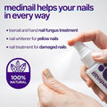 Jaysuing Nail Fungus Spray – Antifungal Treatment 100ml